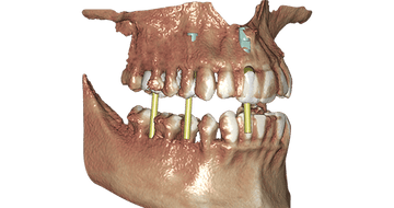 exocad DICOM Viewer (Perpetual Initial Purchase)